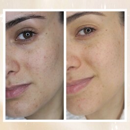 Radiance Overnight Glow Dark Spot Cream - Noční krém