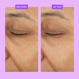 Ceramighty™ AF Eye Balm - Oční krém proti stárnutí