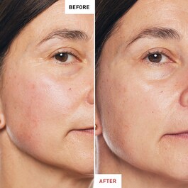 Skin Therapy - Víceúčelový noční olej